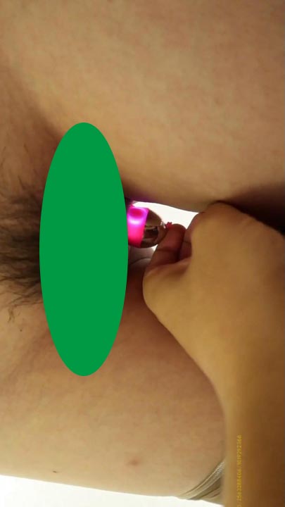 24031111886